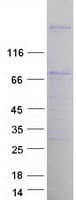 Human SPHKAP Protein (Recombinant Myc-DDK (Flag))