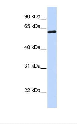 CSTF2 / CstF-64 Antibody (aa182-231)