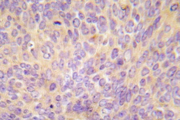 MAP3K5 / ASK1 Antibody (Val972)