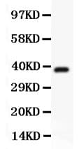 Polyclonal Rabbit anti-Human Hamartin / TSC1 Antibody (aa686-884, WB)