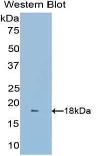 GLRX3 / Glutaredoxin 3 Antibody (aa10-117)