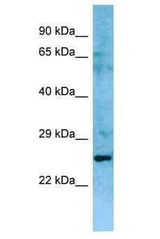 Polyclonal Rabbit anti-Human NIPAL3 / NPAL3 Antibody (aa2-51, WB)