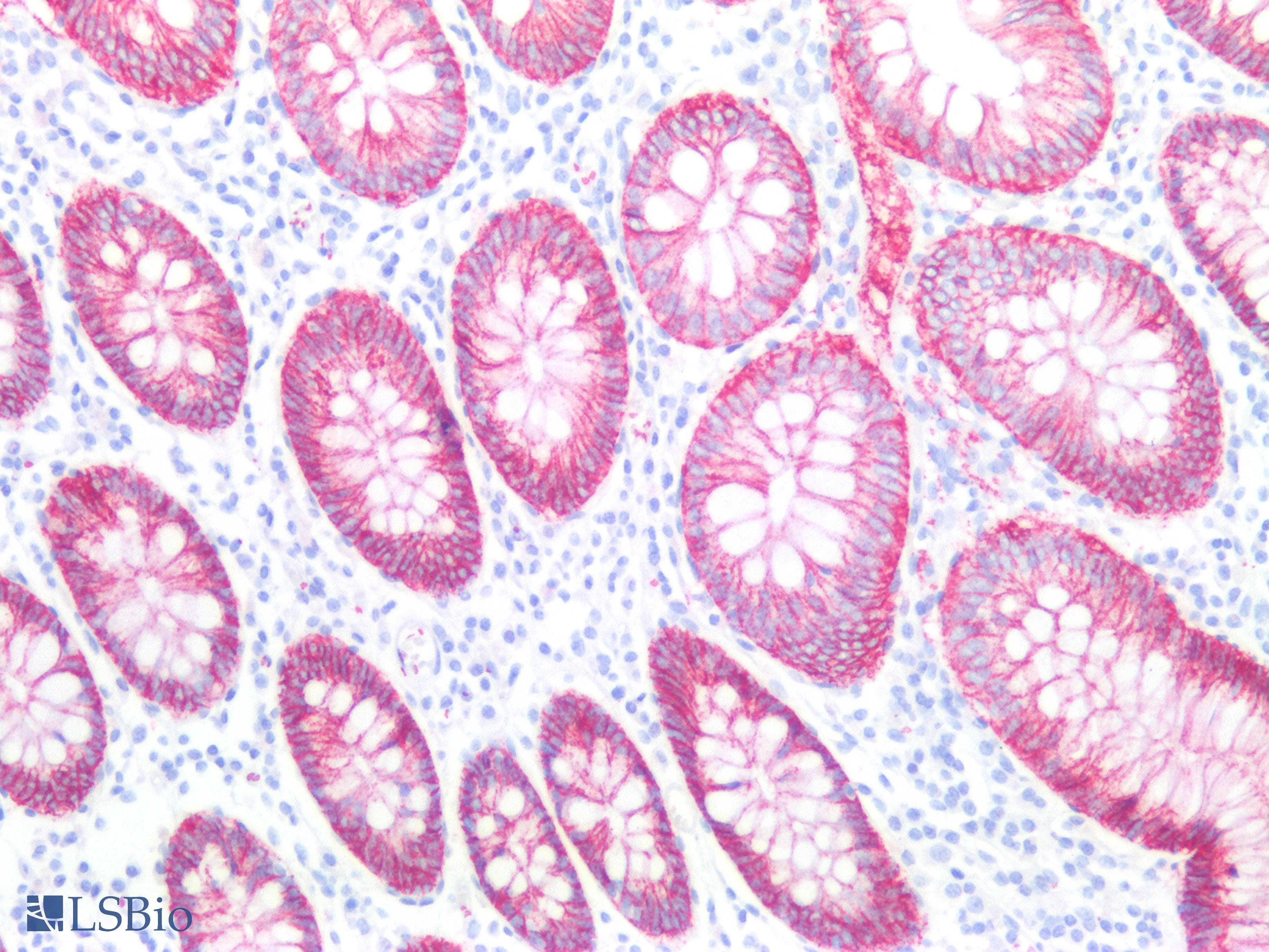 PathPlus™ CLDN1 / Claudin 1 Antibody