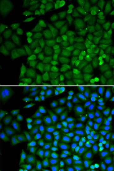 Selenium Binding Protein 1 Antibody