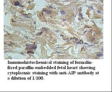 ARA9 / AIP Antibody