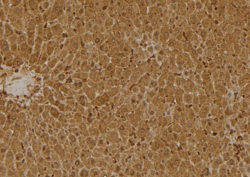 SERPINB9 / PI9 Antibody