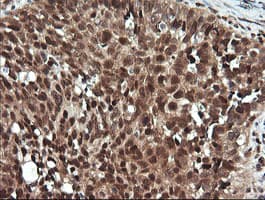 FAK / Focal Adhesion Kinase Antibody (clone OTI4G7)