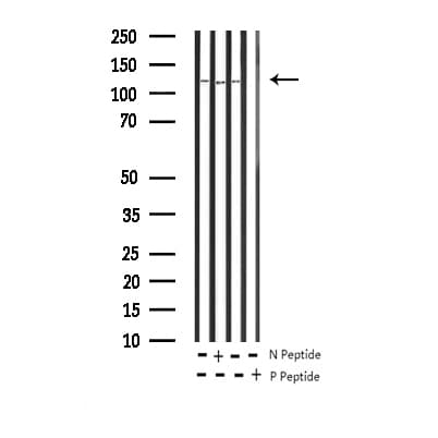 FAK / Focal Adhesion Kinase Antibody (phospho-Tyr397)
