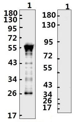SARS-CoV-2 Nucleoprotein Antibody