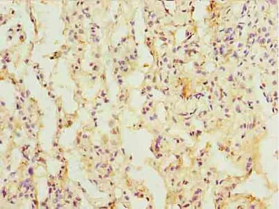 Polyclonal Rabbit anti-Human L3HYPDH / C14orf149 Antibody (IHC, WB)