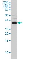 SPRY2 / Sprouty 2 Antibody (clone 1E10)