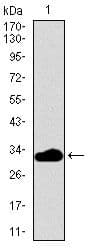 Monoclonal Mouse anti-Human FcERI / Fc Epsilon RI Antibody (clone 1F2A9, Amino Acid: 42-103, WB)