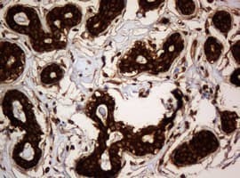PAI-RBP1 / SERBP1 Antibody (aa1-262, clone OTI1E7)