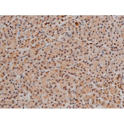 CREB1 / CREB Antibody (phospho-Ser133)