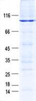 Human ANXA6/Annexin A6/Annexin VI Protein (Recombinant GST, N-terminus + His, C-terminus)