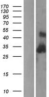 Complement C1QB Protein (Over-Expression Lysate Myc-DDK (Flag))