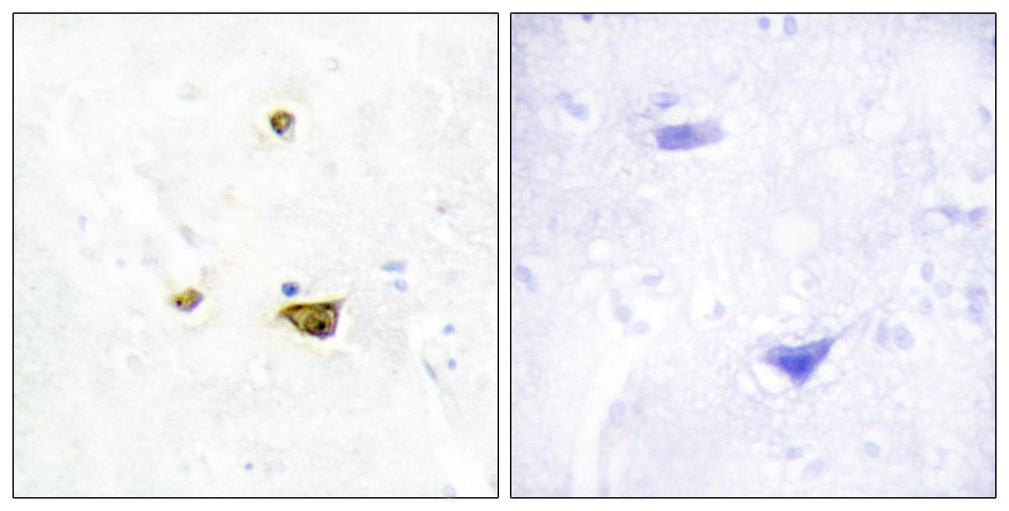 EZH1 / ENX-2 Antibody