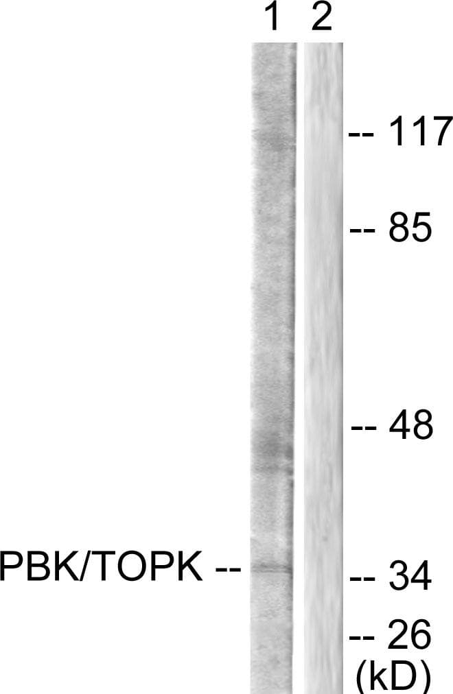 PBK / TOPK Antibody (p9)
