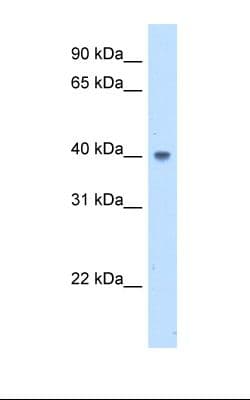 Polyclonal Rabbit anti-Human ABHD5 Antibody (aa101-150, WB)