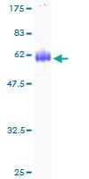 Human SDSL / Serine Dehydratase-Like Protein (Recombinant GST)