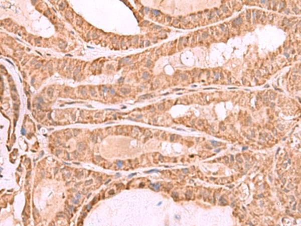 Polyclonal Rabbit anti-Human CDC20 Antibody (IHC)
