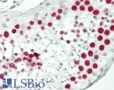 IHC-plus™ TOP2A / Topoisomerase II Alpha Antibody (aa1100-1531, clone 1D2)