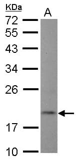 Polyclonal Rabbit anti-Human DNT / NT5C Antibody (WB)