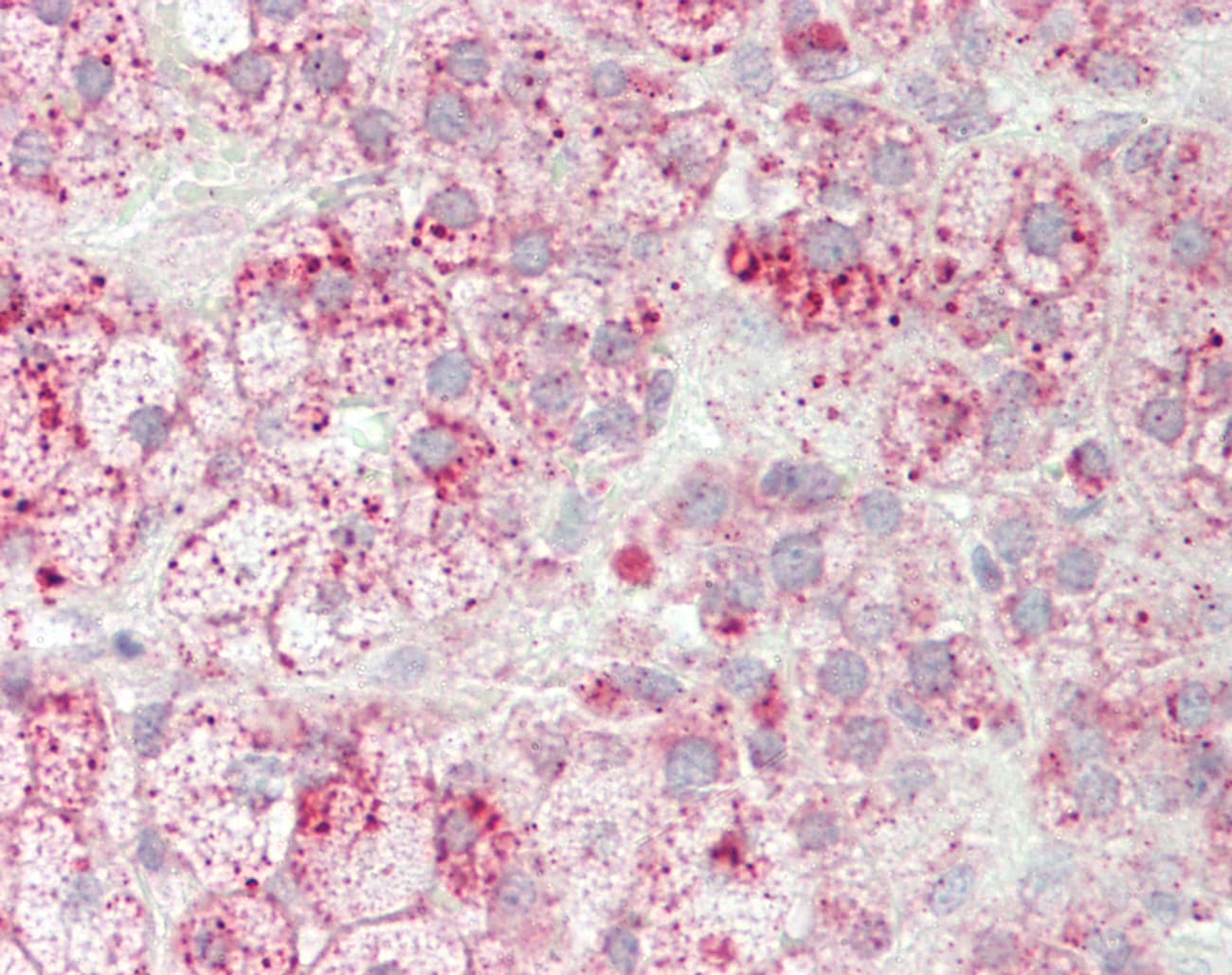 IHC-plus™ ME2 / Malate Dehydrogenase 2 Antibody