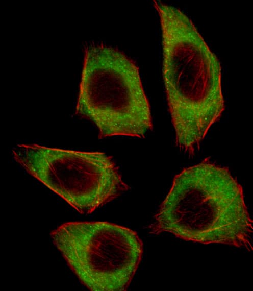 CSRNP2 / FAM130A1 Antibody (aa509-538)
