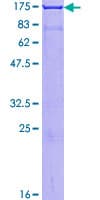 Human AMPH / Amphiphysin Protein (Recombinant GST)