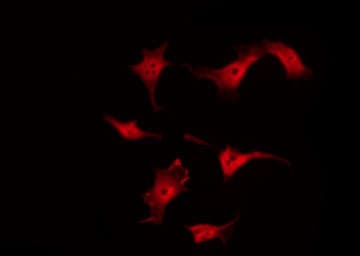 RACGAP1 / MGCRACGAP Antibody