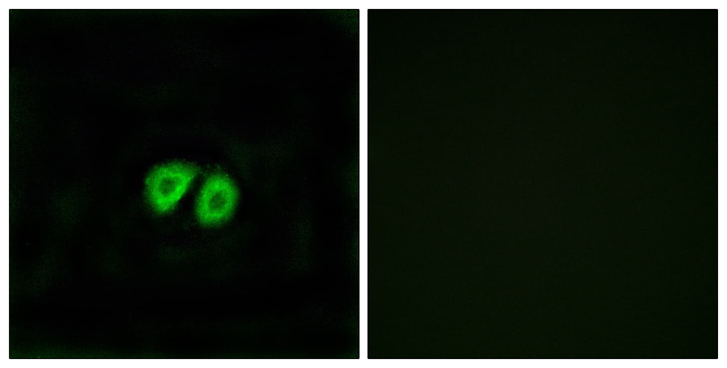 ADGRG1 / GPR56 Antibody (aa251-300)