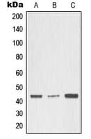 Polyclonal Rabbit anti-Human MMP3 Antibody (Internal, WB)