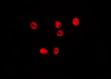 MAPK14 / p38 Antibody (phospho-Tyr182)