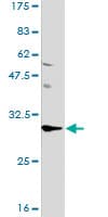 IHC-plus™ Monoclonal Mouse anti-Human PHAP1 / ANP32A Antibody (clone 2G11-4A5, IHC, IF, WB)