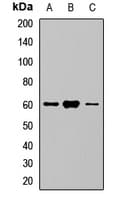 SLC5A1 / SGLT1 Antibody