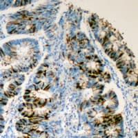 IHC-plus™ ADGRF5 / GPR116 Antibody (N-Terminus)