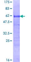 Human CDX2 Protein (Recombinant GST)