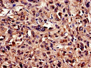 Ubiquilin 2 / UBQLN2 Antibody