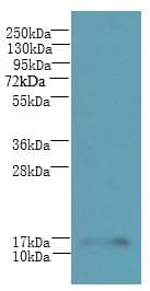 HSPC176 / TRAPPC2L Antibody