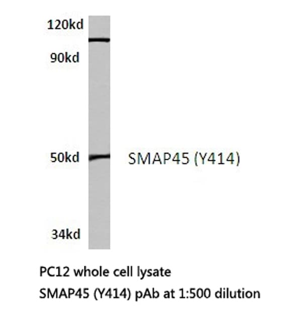 Polyclonal Rabbit anti-Human HDAC3 Antibody (Tyr414, IHC, IF, WB)