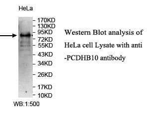 PCDHB10 Antibody (aa27-692)