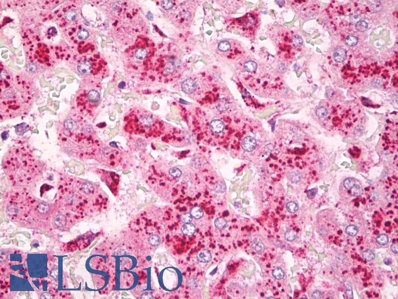 IHC-plus™ CYSLT2 / CYSLTR2 Antibody