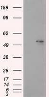 Monoclonal Mouse anti-Human ALDH3A1 Antibody (clone OTI1C6, IHC, IF, WB)