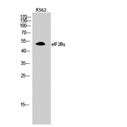 EIF2B3 Antibody (240-320 aa, Internal)