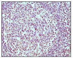 CD19 Antibody (clone 2E2B6B10)