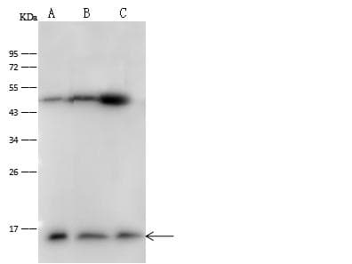Polyclonal Rabbit anti-Human PFN1 / Profilin 1 Antibody (Preservative Free, IF, WB)