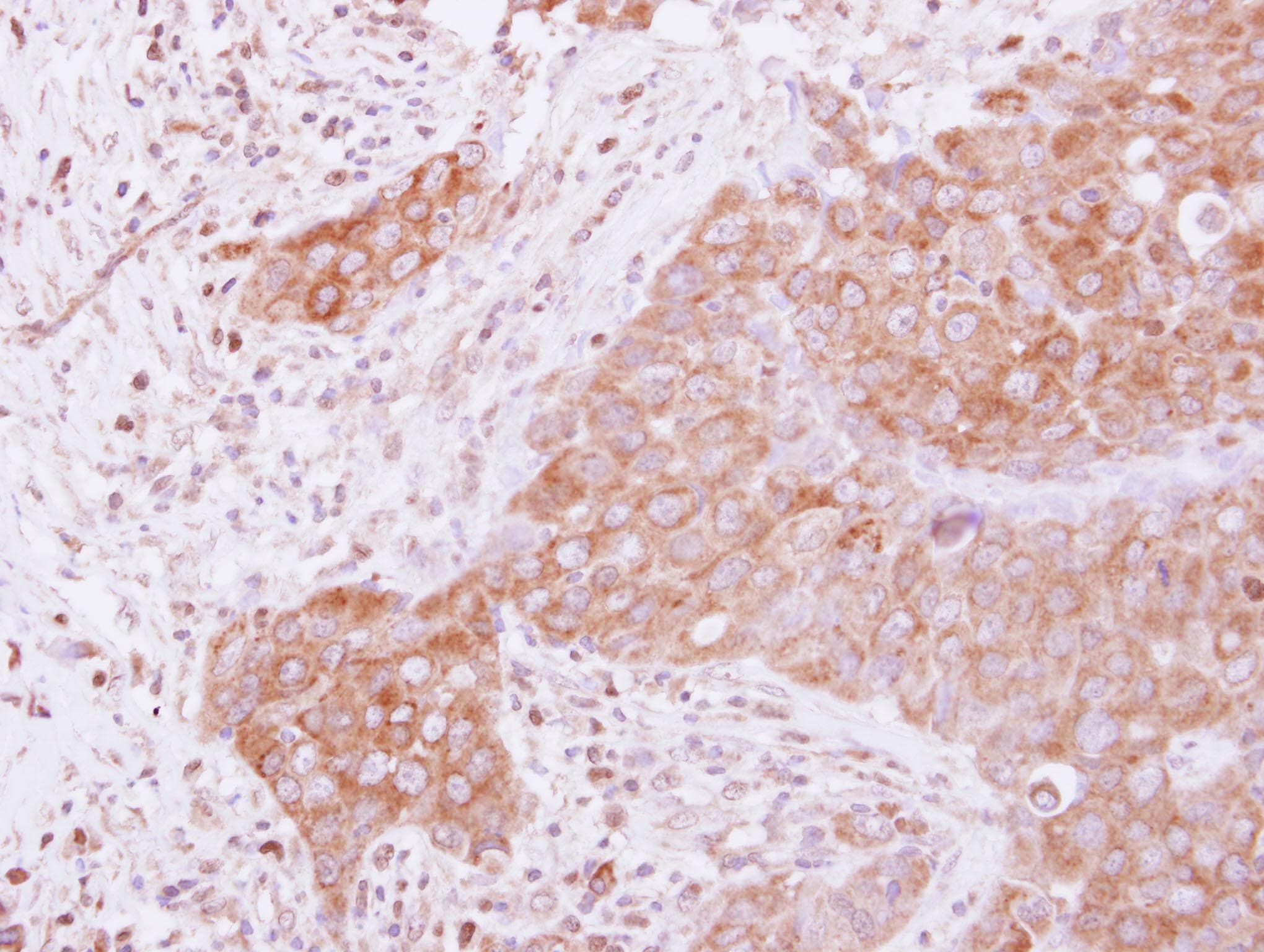 GSPT1 Antibody