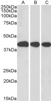 IHC-plus™ MORF4L1 / MRG15 Antibody (aa2-14)
