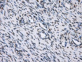 LOX / Lysyl Oxidase Antibody (clone OTI8G5)